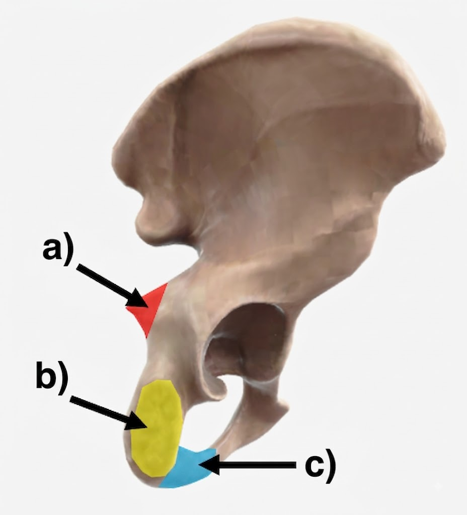 <p>can you fill out this following diagram that displays a lateral posterior view of the os coxae and say what bone all these areas are apart of?</p>