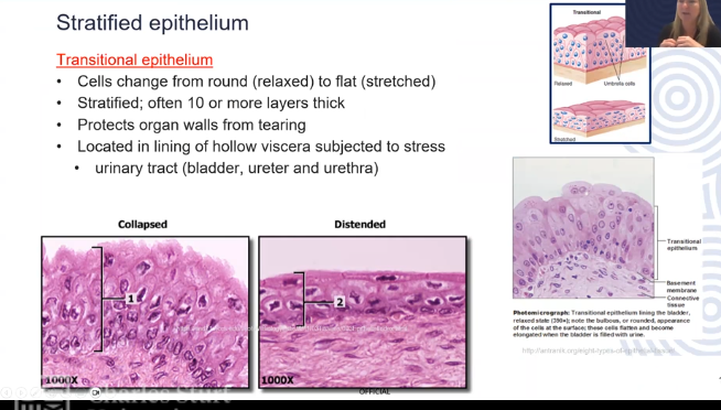 <p>Cells change from round (relaxed) to flat (stretched)</p><p>Stratified (usually 10 or more layers)</p><p>Protects organ walls from tearing</p><p>Located in lining of hollow viscera subjected to stress (urinary tract)</p>