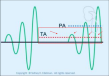 <p>Pulse Average Intensity </p>