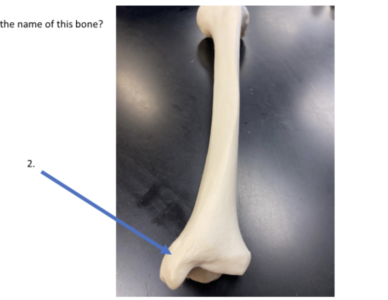 <p>what is the name of #2</p>