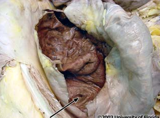<p>what structure in the large intestine is this (be specfic)?</p>