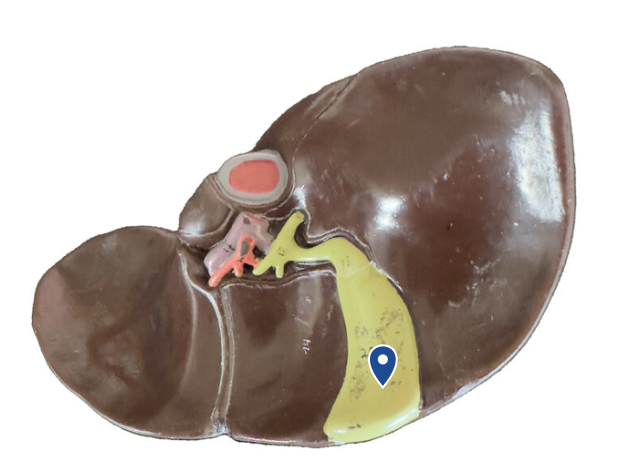 <p>Name this organ.</p>