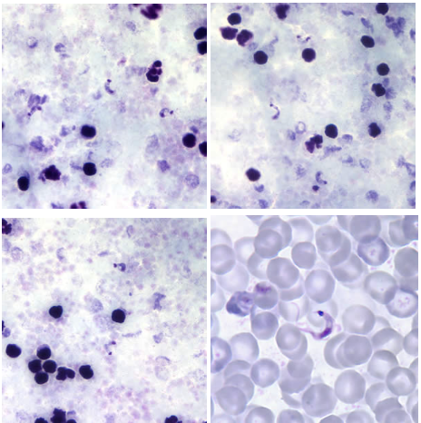 <p>Identify the parasite and its stage.</p><p>Disease:</p><p>Vector:</p><p>Transmission:</p><p>Infective stage:</p><p>Diagnostic stage:</p><p>Treatment:</p>