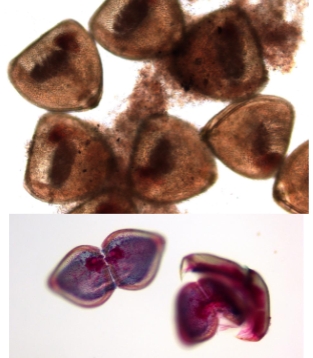 <ol><li><p>identify kingdom, phylum, class, and genus</p></li></ol><ol start="2"><li><p>what stage of the life cycle is this</p></li></ol><p></p>