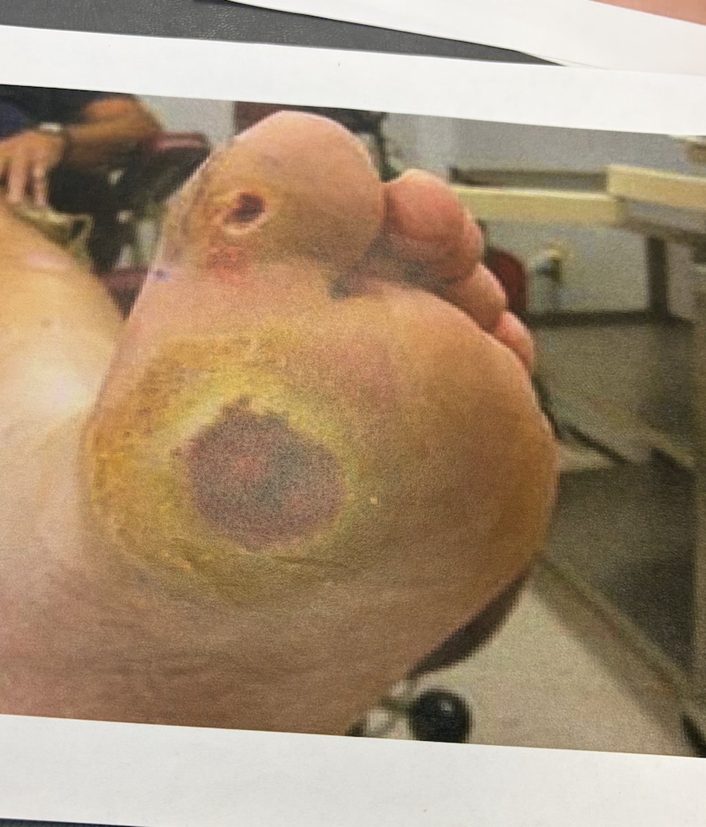 <p>what wound is this?</p>