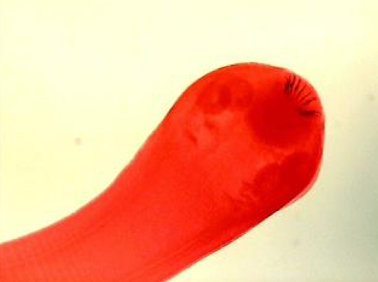<p>phylum: platyhelminthes</p>