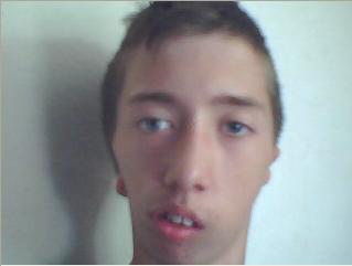 <p>what syndrome </p>