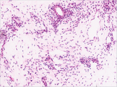 <p>Identify</p>