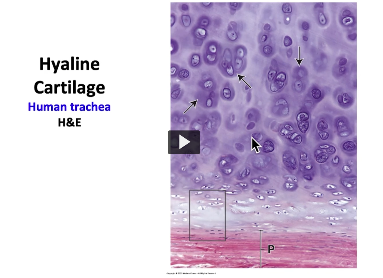 <p>Observe the big areas pointing at the territorial matrix and the clear areas between the individual chondrocytes or isogenous groups is the interterritorial matrix </p><p>Dark purple at the top: isogenous group</p><p>isogenous group (I think its groups that are formed from the same cellular division)</p><p>If I go to the periphery (P), then I am in the chondrogenic layer of the perichondrium. This area is a perichondrium (the pink at the bottom). </p><p>This square demarcates the chondrogenic layer and the cells within that area are the chondroblasts. </p><p>If I magnifiy this area of the perichondrium, this is what I can observe (next slide) </p>