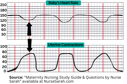 <p>Are early decelerations indicative of fetal distress or hypoxia?</p>