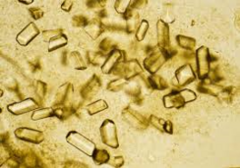 <p>At acidic urine pH levels below 5.7, what type of crystals are formed?</p><p>painful accumulation in joints or present in kidney stones</p>