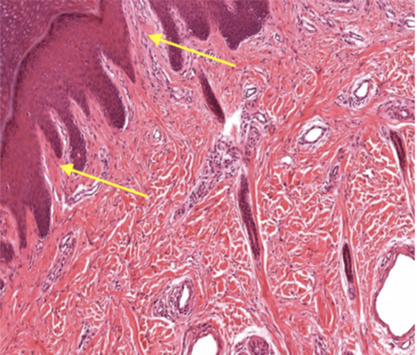 <p>Identify the structure</p>