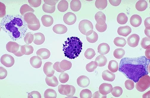 <p>what is the leukocyte in the center?</p>