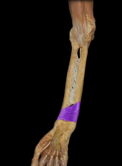 term image
