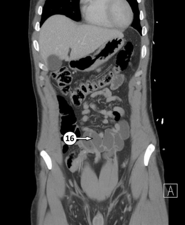 <p>No. 16 is ileum of the small intestine. Please label the epithelium type and it’s function </p>