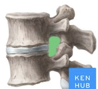 <p>whats the green opening ? </p>