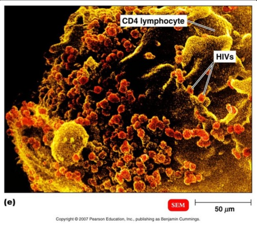 <p>human immunodeficiency virus type 1; causes AIDs, originally found in chimpanzees and primates, HIV on the surface of a CD4 cell </p>