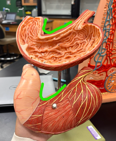 <p>What is the arrow pointing at?</p>