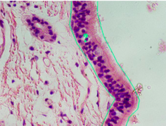 <p>identify the tissue</p>