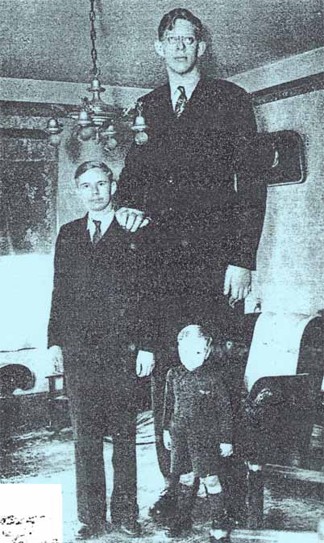 <p>gigantism</p>