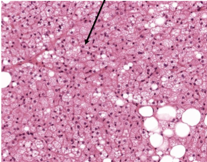 <p>Slide 22</p>