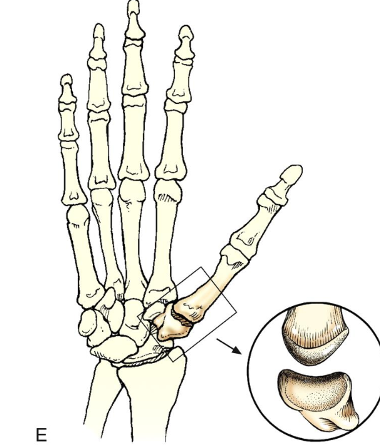 <p>Saddle joint</p>