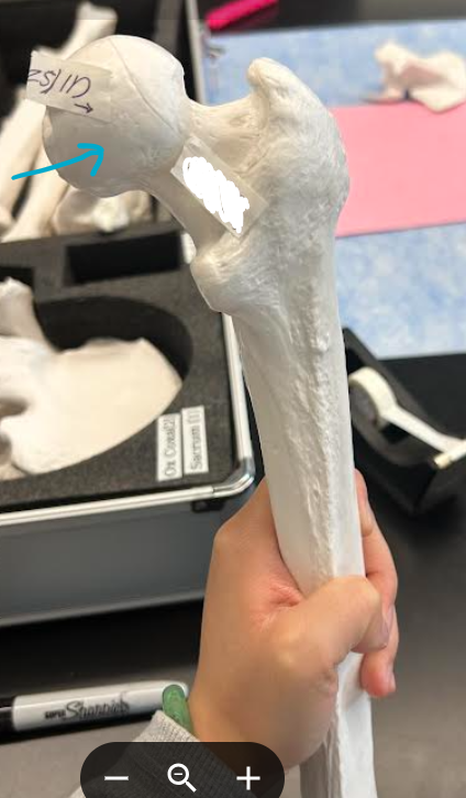 <p>ID femur/os coxae region </p>