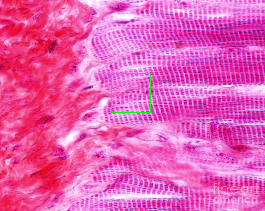 <p>Identify the junction:</p>