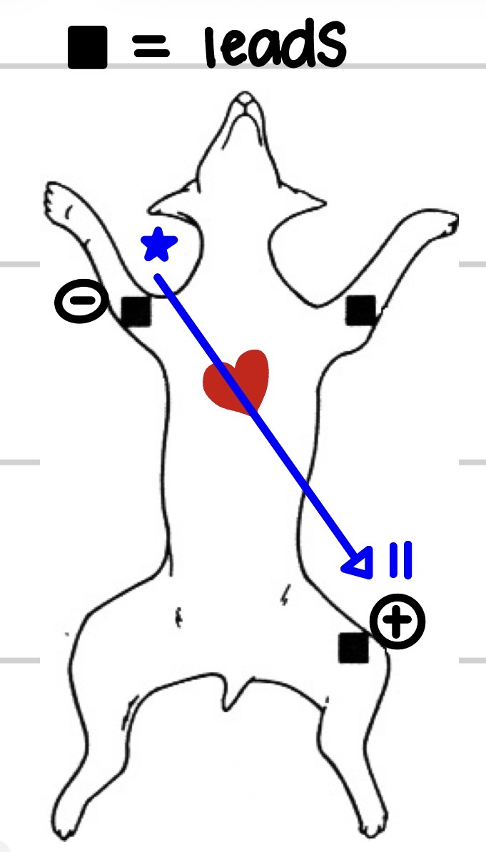 <p>Lead II ( neg electrode on R arm, pos electrode on L leg) </p>