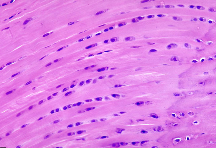<p>fibrocartilage connective tissue</p>