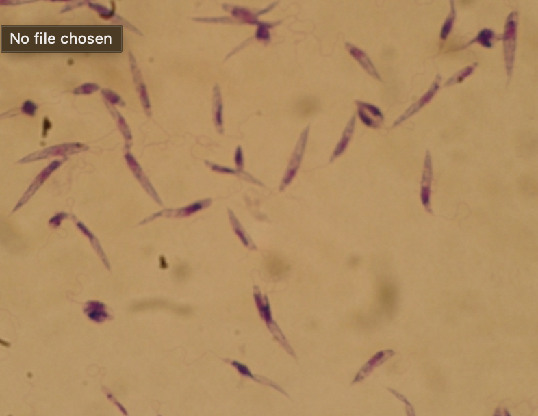 <p>What protist is this?</p>