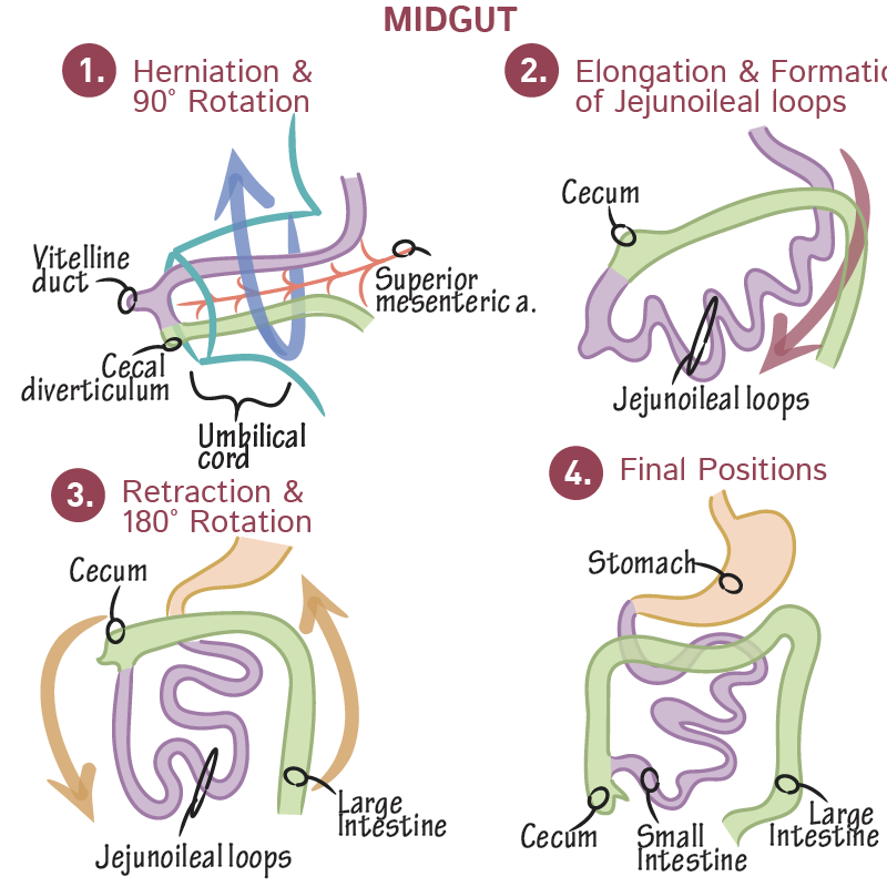 <ol><li><p><mark data-color="purple" style="background-color: purple; color: inherit;">herniation and counterclockwise rotation</mark>: <strong>counterclockwise</strong> rotation about the axis of the<strong> superior mesenteric artery.</strong> <strong>midgu</strong>t comprises the <strong>primary intestinal loop</strong> which elongates so rapidly that it temporarily outgrows the abdominal cavity, <strong>herniating</strong> into the umbilical cord</p></li><li><p><mark data-color="purple" style="background-color: purple; color: inherit;">elongation:</mark> the <strong>caecum</strong> is now on the <strong>right hand </strong>side, as it has undergone a <strong>270 degree </strong>rotation now (in pigs this is 450) . the rotated primary loop elongates rapidly creating the<strong> jejunoileal loops</strong></p></li><li><p><mark data-color="purple" style="background-color: purple; color: inherit;">retraction and counterclockwise rotation</mark>: loops <strong>retract</strong> from the umbilical cord into the abdominal cavity, and the intestines rotate <strong>180 degrees </strong>counterclockwise as they continue to elongate. caecum now in <strong>upper right.</strong></p></li><li><p><mark data-color="purple" style="background-color: purple; color: inherit;">final positions:</mark> large intestine frames the small intestine. caecum now in the <strong>lower right</strong></p></li></ol><p></p>