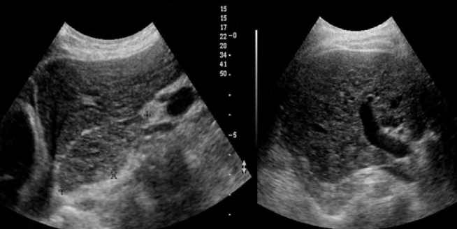 <p>Identify this image. </p>