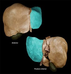 <p>Identify the structure</p>