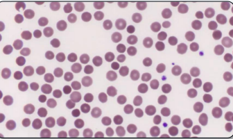 <p>what type of erythrocyte cell is this?</p>