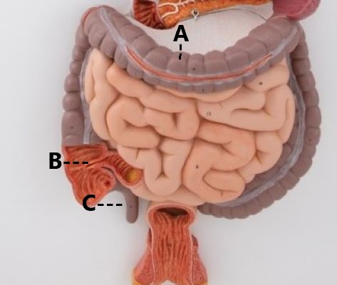 <p>A</p>