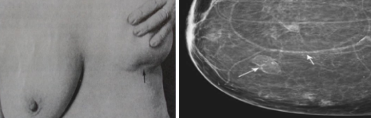 <p>What pathology?</p>