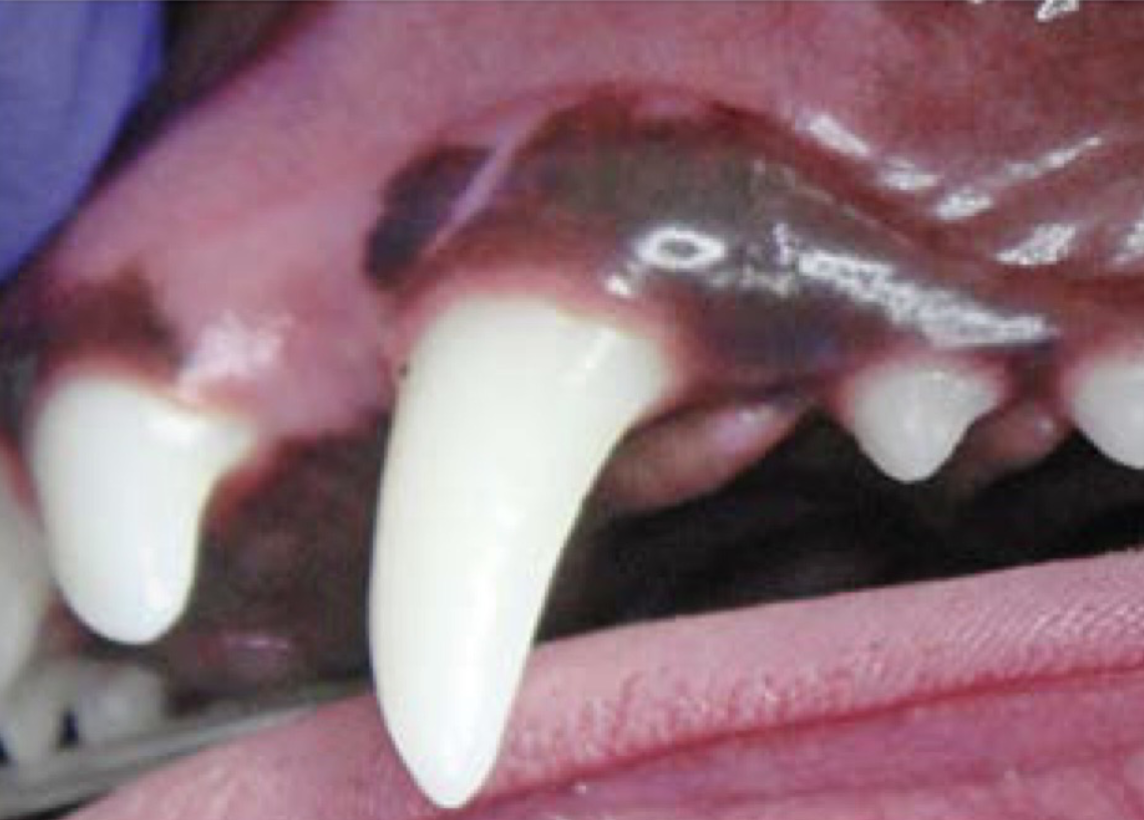 <p>Gingival Index Grading: none</p>