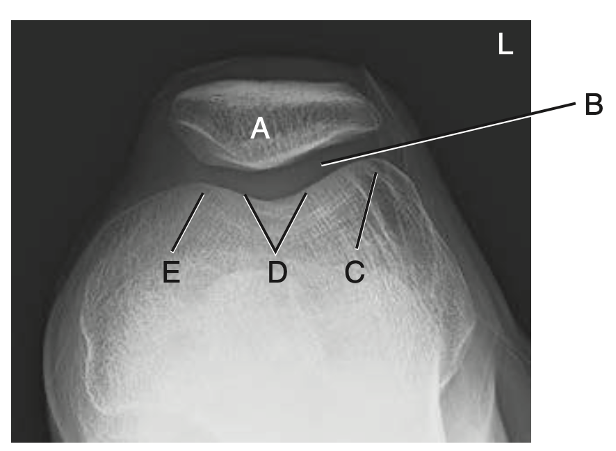 <p>A</p>