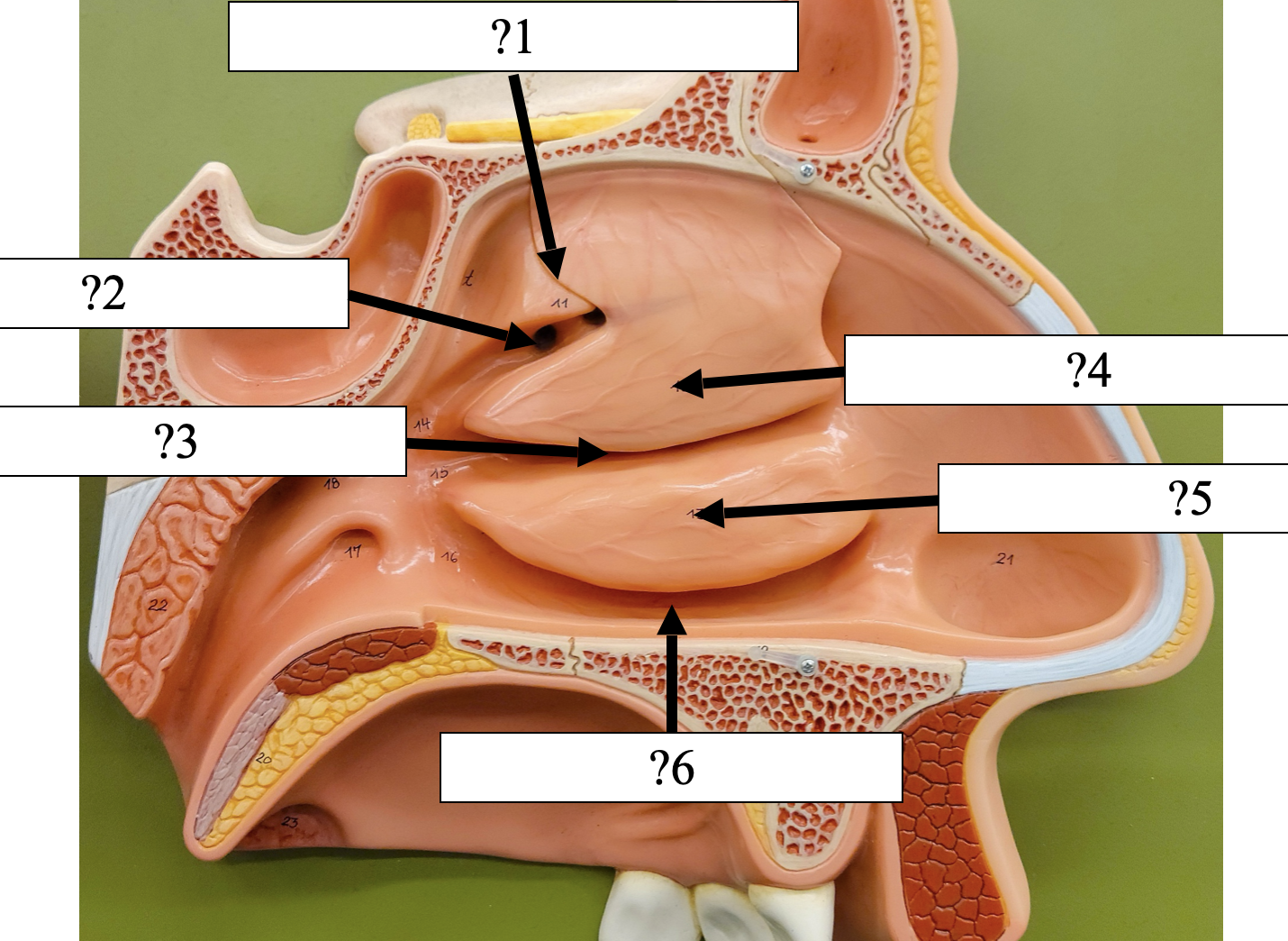 <p>4 Name the bone?</p>