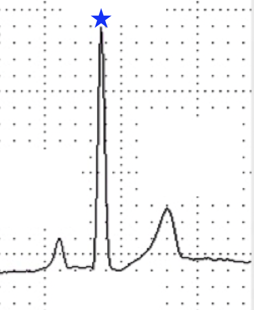 <p>What wave is indicated by the blue star?</p>