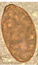 <p>Eggs that look like this were found on a fecal flotation of a dog presenting with hemorrhagic enteritis &amp; other signs similar to canine parvovirus. What etiologic agent is responsible for the clinical signs?</p>