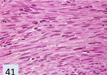 <p>what tissue is this? </p>