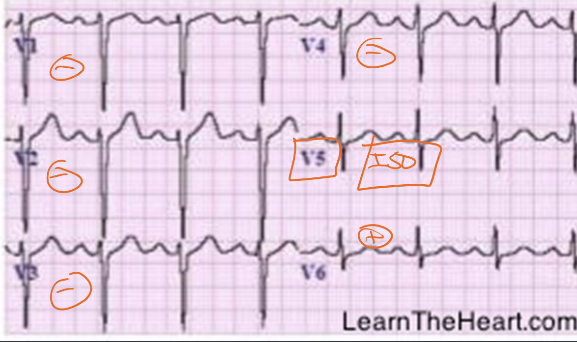 <p>Axis rotation?</p>