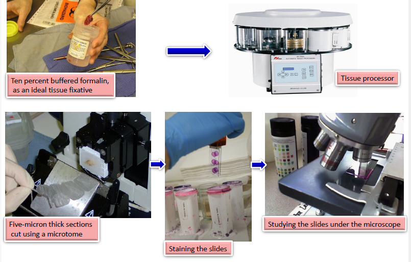 <ul><li><p>ten percent buffered formalin, as an ideal tissue fixative → tissue processor→ five micron thick section cute using a microtome→ staining the slides→ studying the slides under the microscope </p></li></ul><p></p>