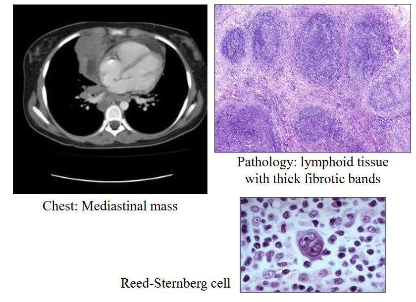 <p>DIAGRAM ON SLIDE 26</p>