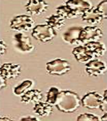 <p>Water moves <span style="color: red;"><strong><mark data-color="red" style="background-color: red; color: inherit;">out of cells</mark></strong></span> → <span style="color: red;"><strong>cells shrink</strong></span></p>