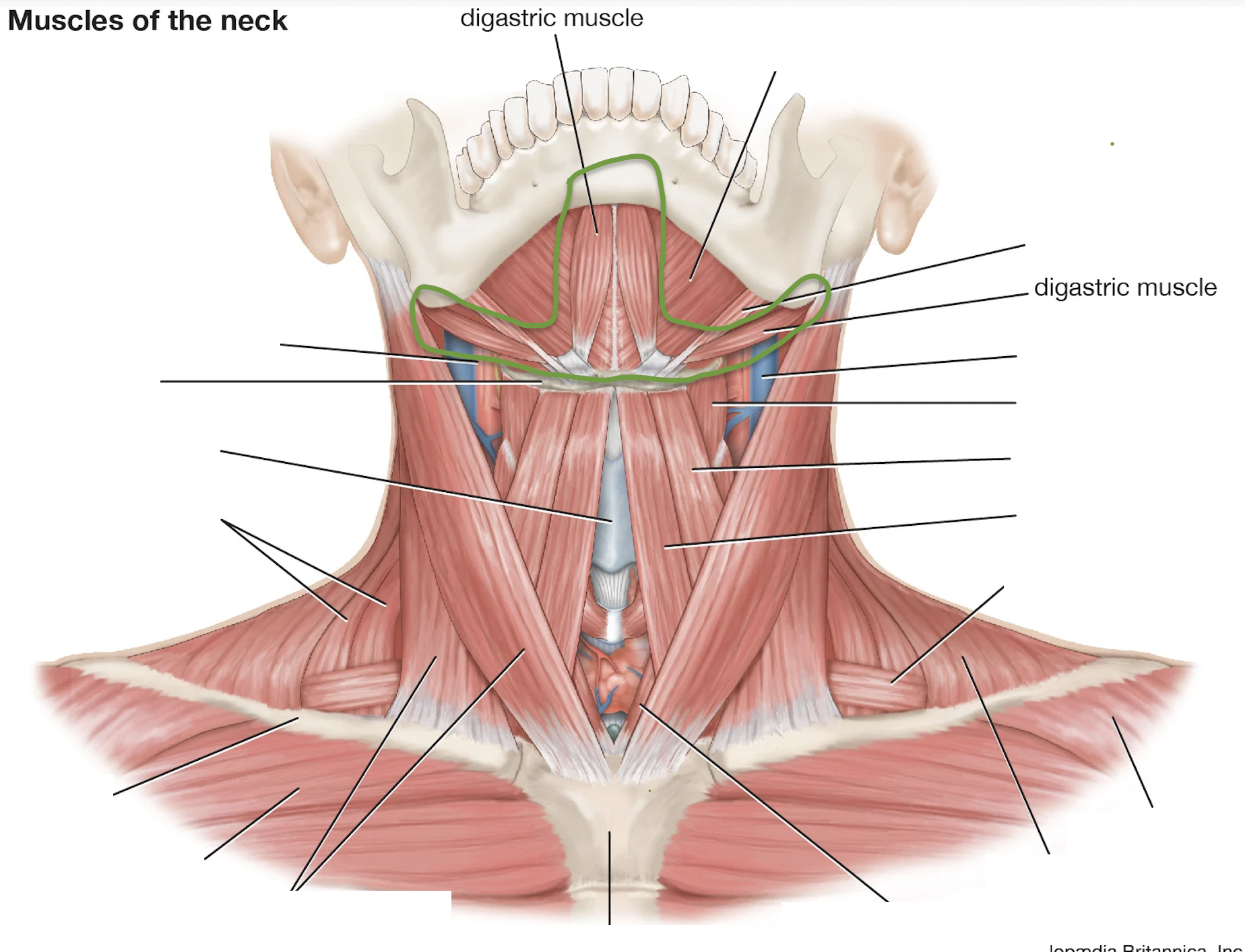 <p>Above Hyoid</p>