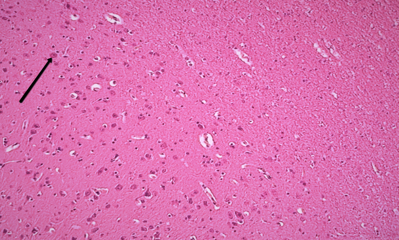 <p><span>Identify the large cell at the tip of the pointer.</span></p>