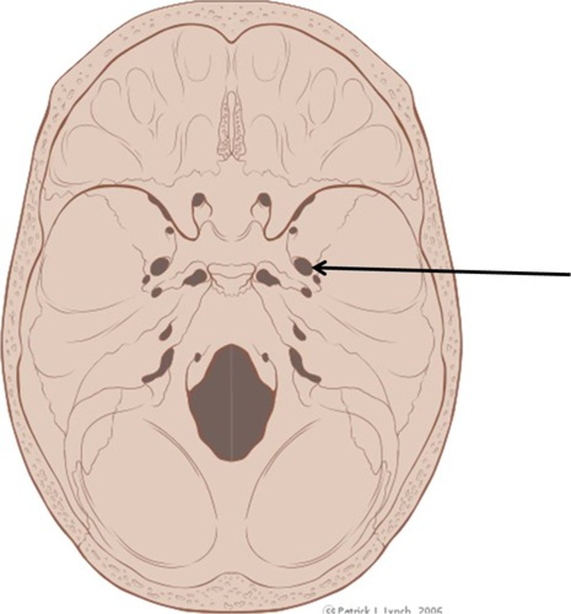 <p>ID hole</p>